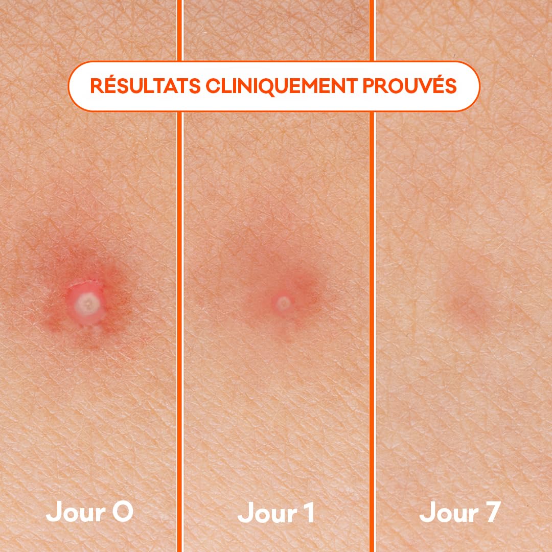 bior-patch-3-en-1-anti-boutons-hydrocollo-de-x24 image 8
